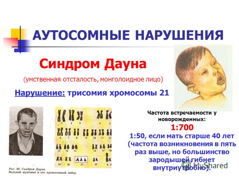На гландах белые комочки чем лечить