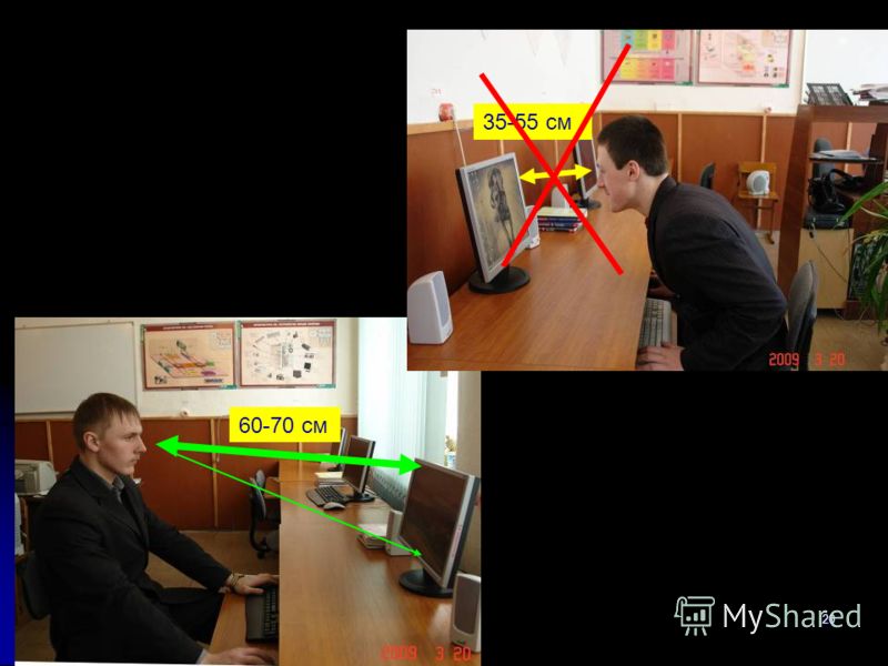Остеохондроз боли в мышцах рук Остеохондроз боли в мышцах рук