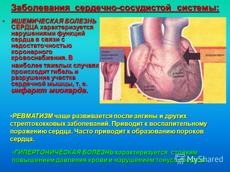 Заболевания сердечно-сосудистой системы: ИШЕМИЧЕСКАЯ БОЛЕЗНЬ СЕРДЦА характеризуется нарушениями функций сердца в связи с недостаточностью коронарного кровоснабжения. ВИШЕМИЧЕСКАЯ БОЛЕЗНЬ СЕРДЦА характеризуется нарушениями функций сердца в связи с нед