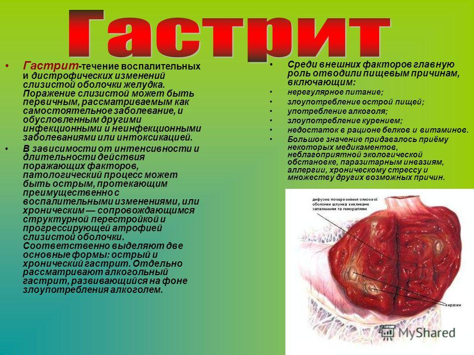 Болезни связаны с курением Болезни связаны с курением