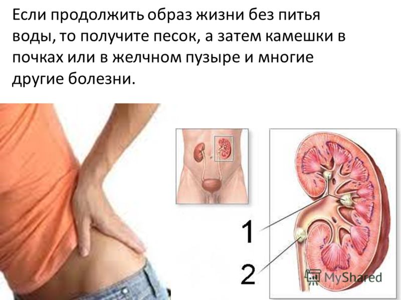 Кто болел менингитом