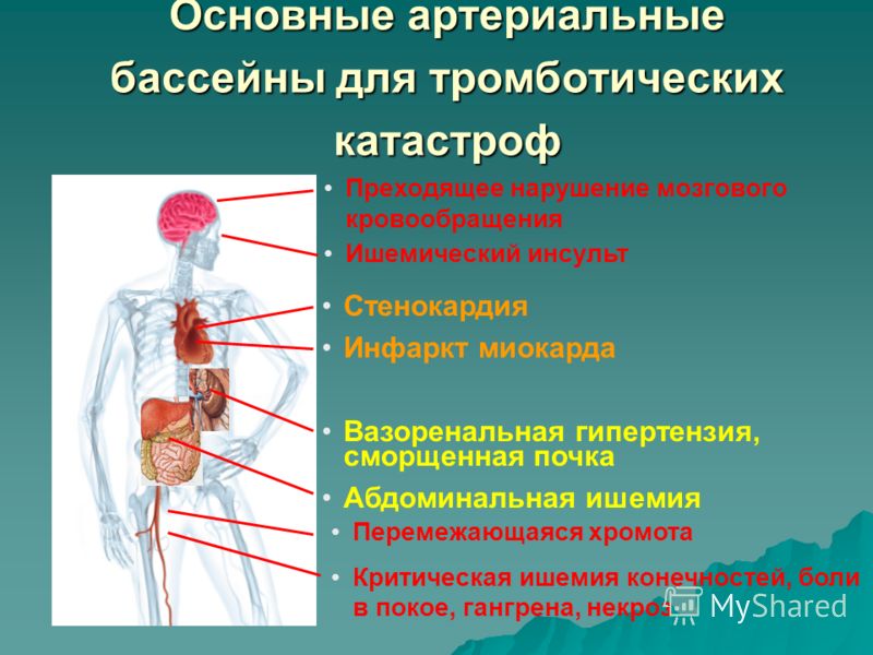 Схема лечения нарушения кровообращения Схема лечения нарушения кровообращения