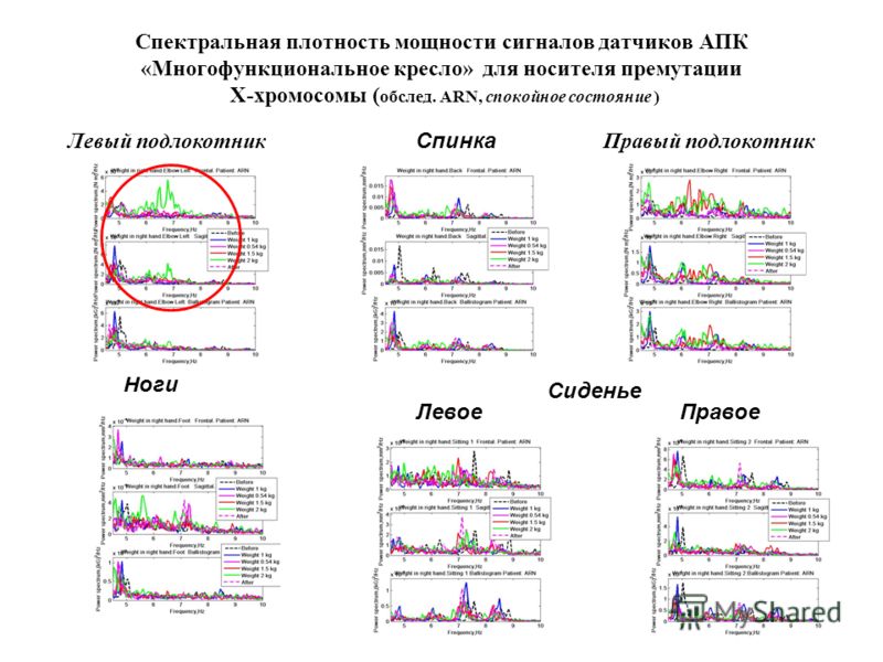Спектральная плотность мощности сигналов датчиков АПК «Многофункциональное кресло» для носителя премутации Х-хромосомы ( обслед. ARN, спокойное состояние ) Левый подлокотникПравый подлокотник Спинка Ноги Сиденье ПравоеЛевое