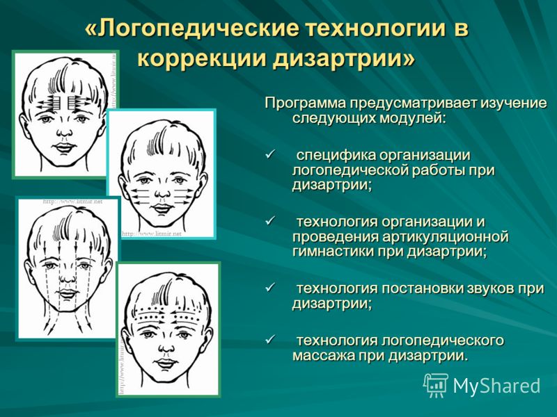 Коррекция артикуляционной моторики при дизартрии Коррекция артикуляционной моторики при дизартрии
