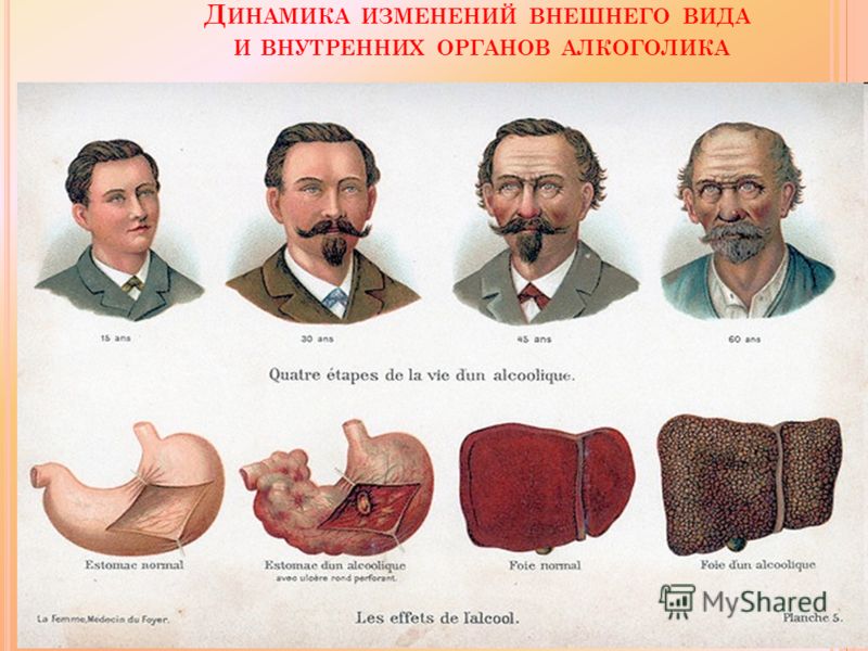 Колме украина инструкция отзывы