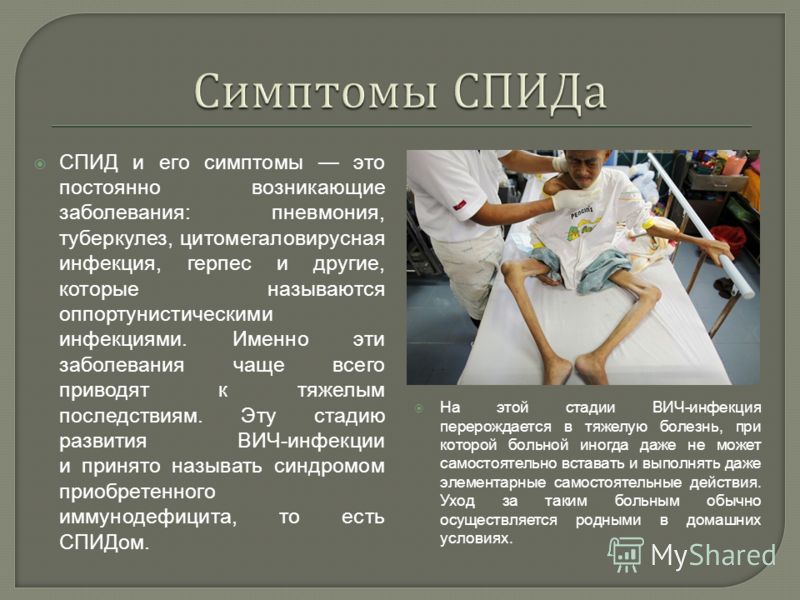 Как лечить вич у мужчин в домашних условиях Как лечить вич у мужчин в домашних условиях