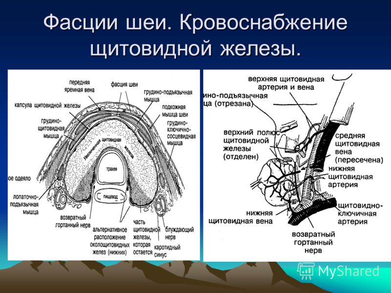 Ультразвуковая Диагностика Заболеваний Щитовидной Железы