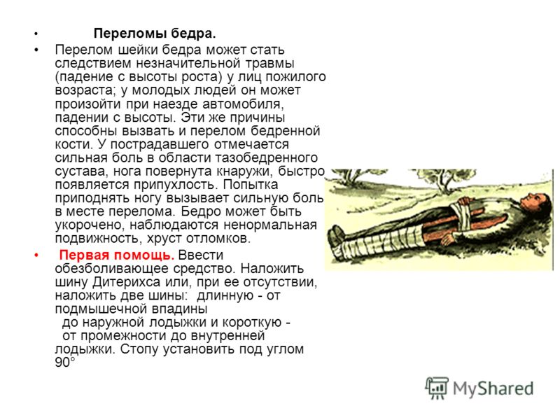 боль с внутренней стороны локтя БОЛИТ ЛОКОТЬ ПРИ СГИБАНИИ - Болит рука на сгибе локтя с.