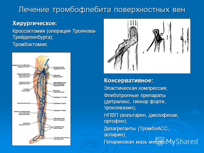 Травы для разжижения крови при варикозе