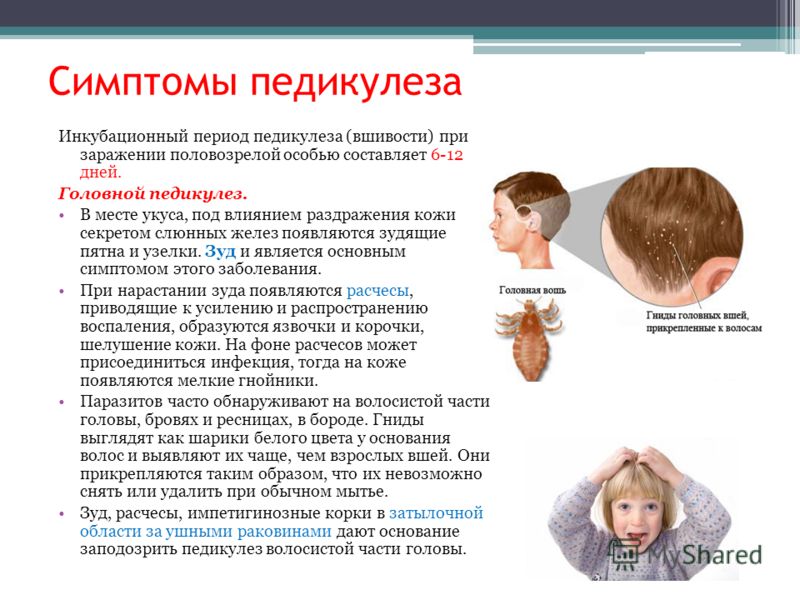 педикулёз симптомы фото педикулёз симптомы фото