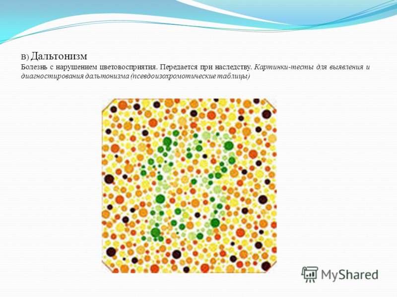 Миопия передается по наследству они