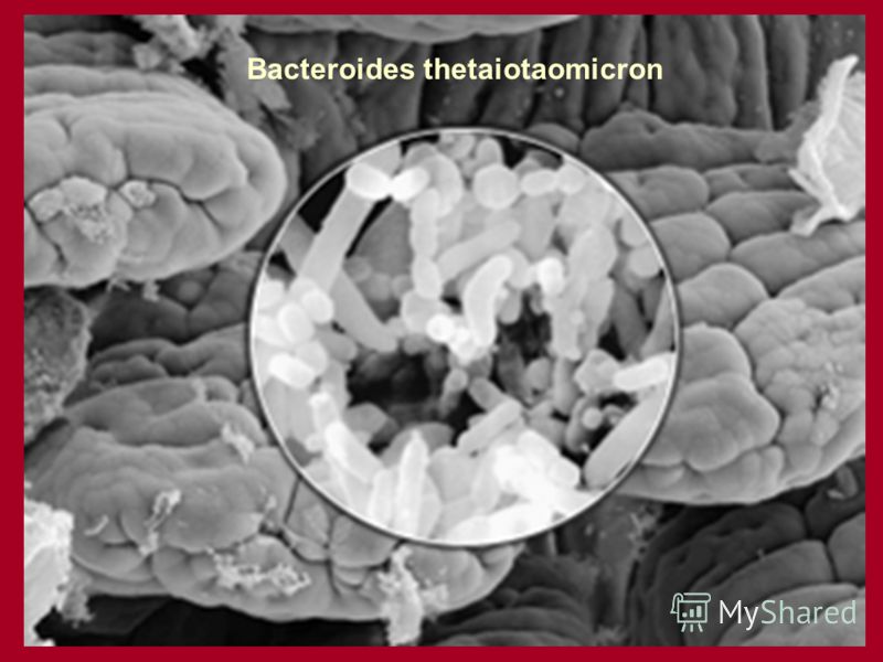 Bacteroides thetaiotaomicron