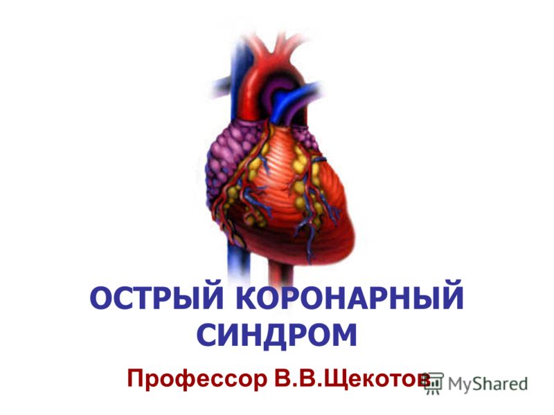 Презентация на тему острый коронарный синдром