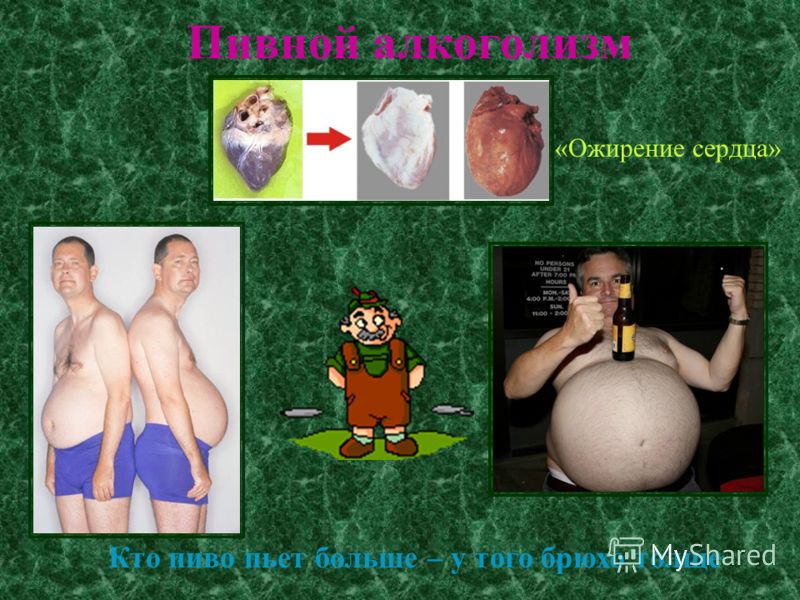 Зорекс кто пробовал