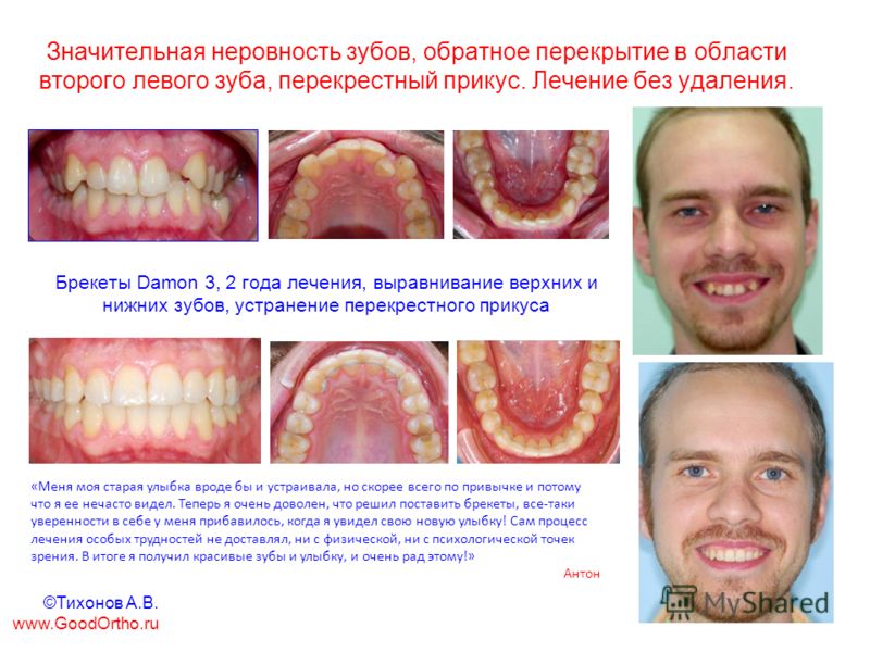 Когда ребенок начинает держать голову? Любящая К чему снятся длинные волосы? Сонник длинные волосы