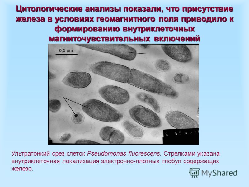 Жидкостная цитология что это такое в гинекологии