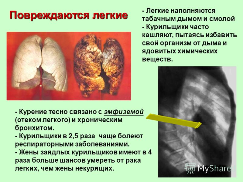Волосы на лице с чем это связано Волосы на лице с чем это связано