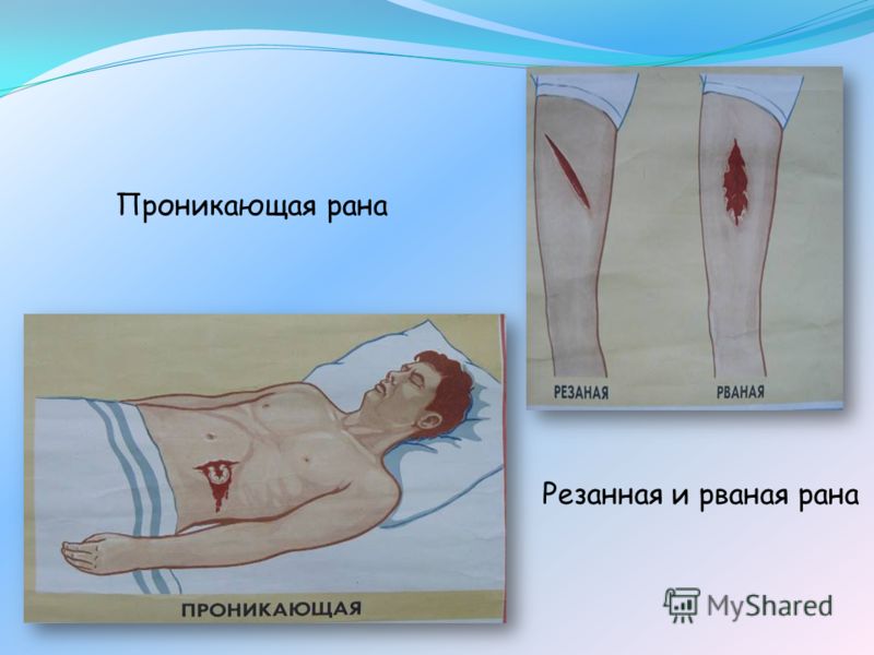 Если рана без кожи Если рана без кожи