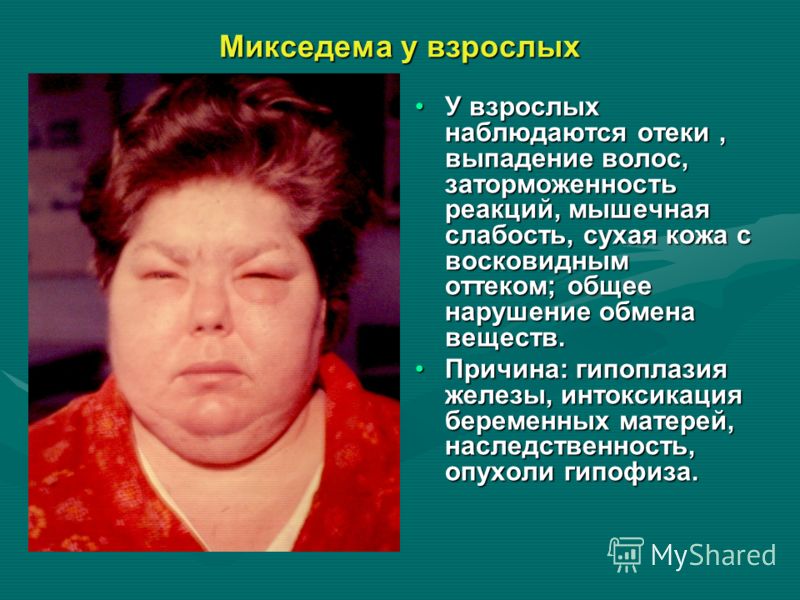 Базовая выкройки пиджака. -уроки кроя и шитья Cached