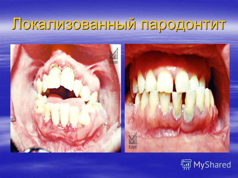 Аллергия на красные продукты у детей фото Аллергия на красные продукты у детей фото