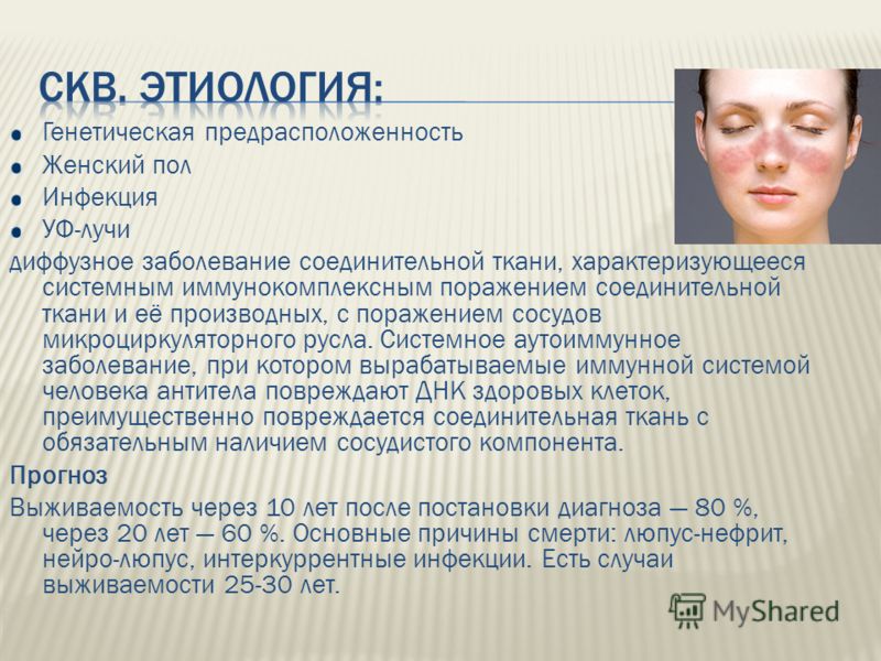 Лечение аутоиммунного тиреоидита пример из нашей практики