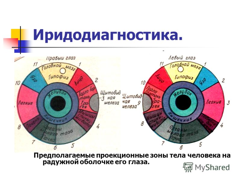 Иридодиагностика схема радужной оболочке глаза 47