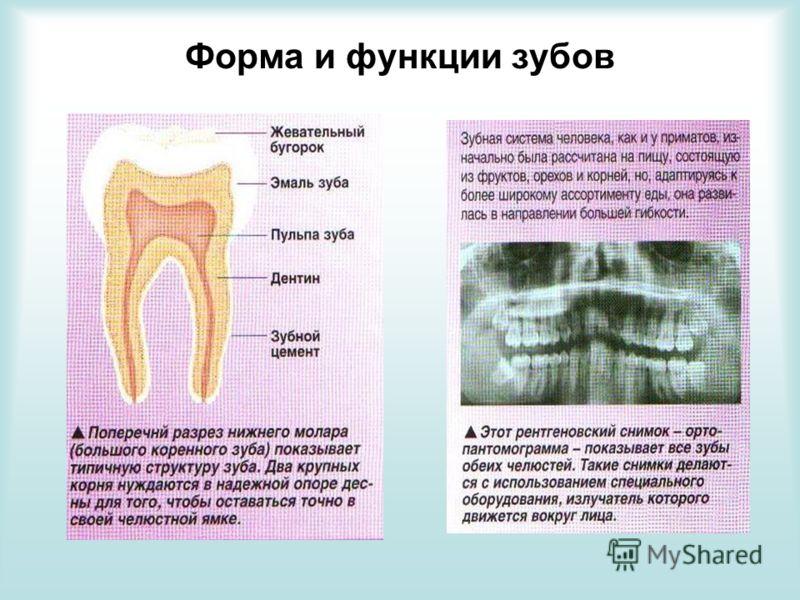 Кариес это заболевание связанное с Кариес это заболевание связанное с