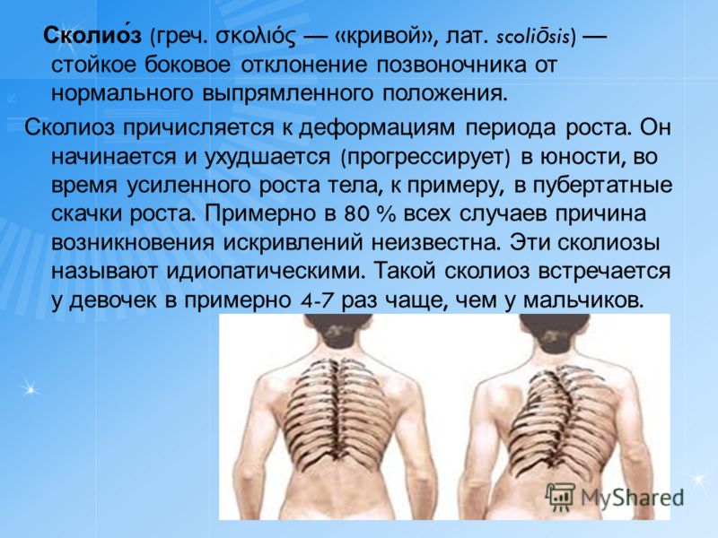 Как сделать пластичным позвоночник Как сделать пластичным позвоночник