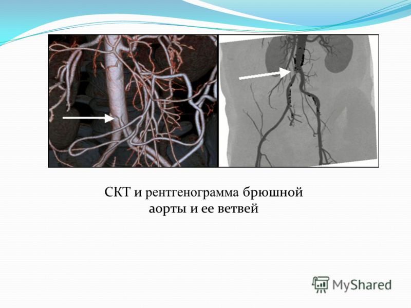 Вологодская областная детская поликлиника на пошехонском шоссе телефон