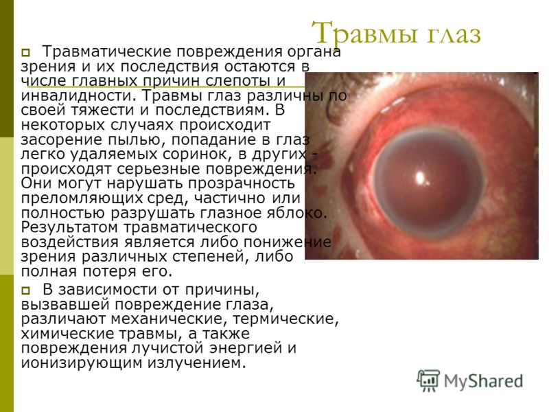 Травма глаза лечение в домашних условиях Травма глаза лечение в домашних условиях