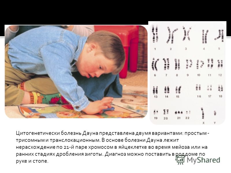 Боль отдает в пах и поясницу