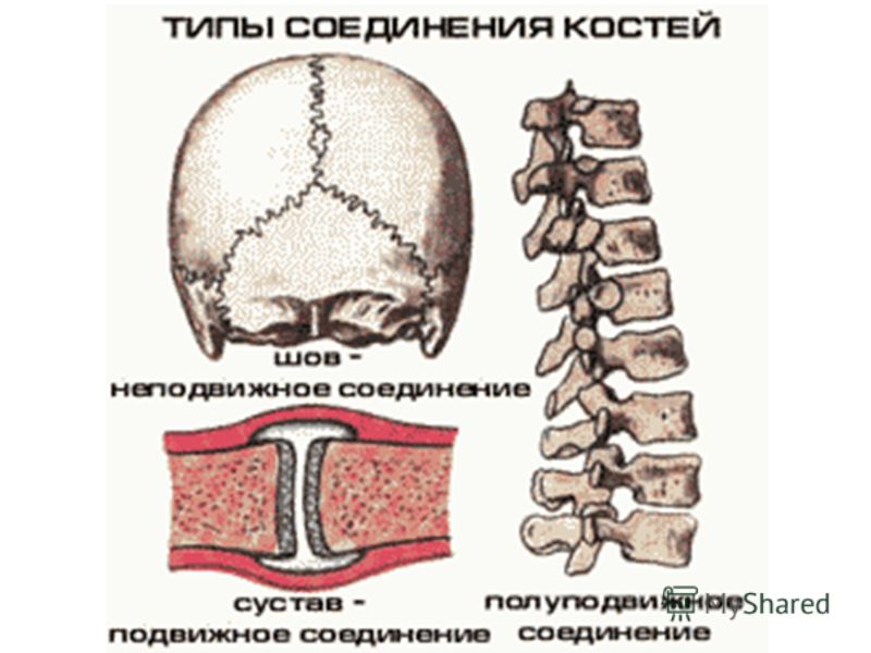 Неподвижно соединены между собой кости позвоночника Неподвижно соединены между собой кости позвоночника