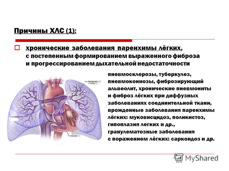 Пульмосклероз легких что это такое и как лечить Пульмосклероз легких что это такое и как лечить