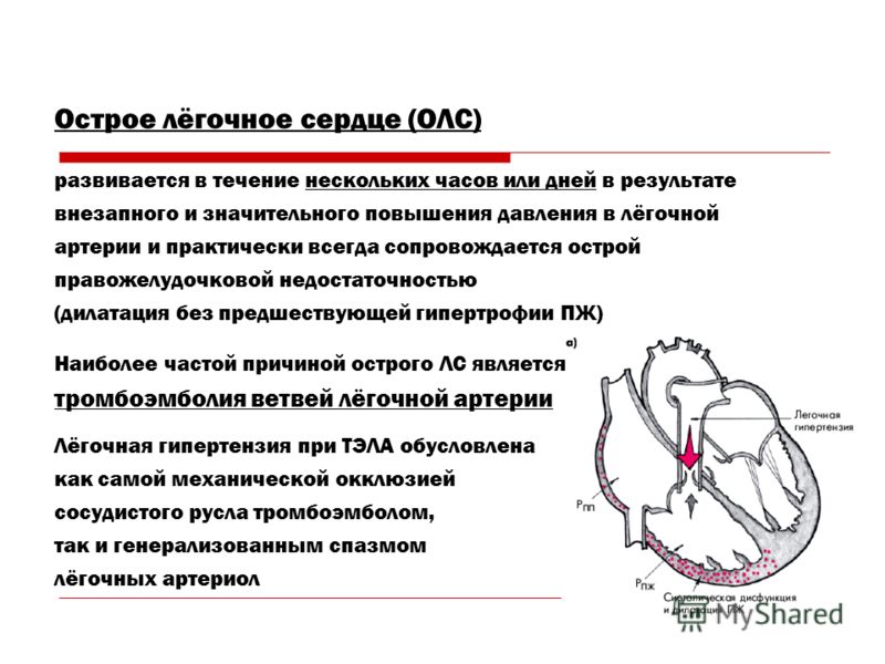 Причина возникновения кисты на почке лечение