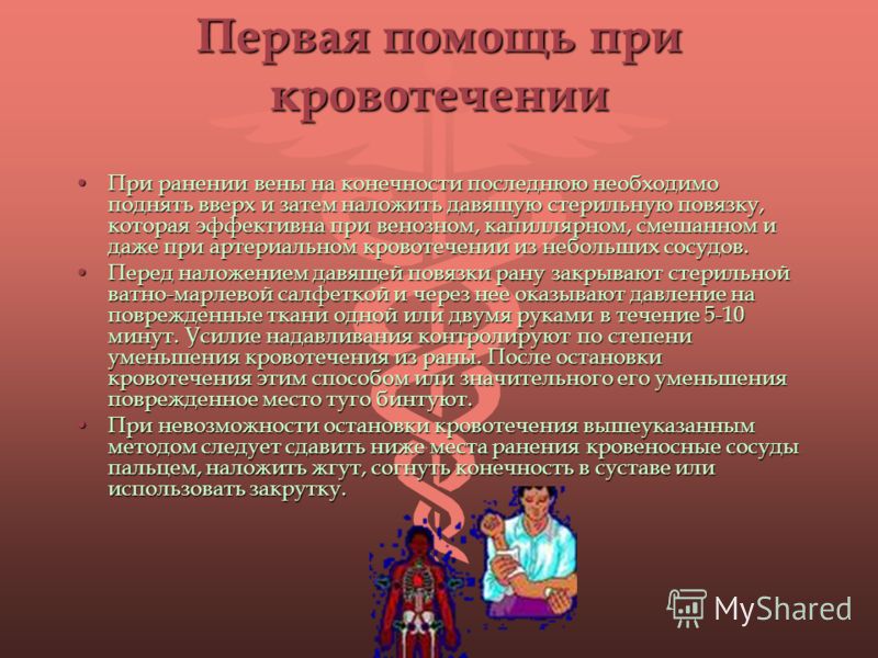 Пункция подключичной вены по сельдингеру