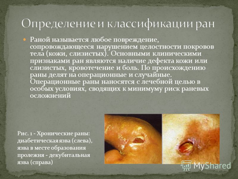 Презентация уход за ранами Презентация уход за ранами