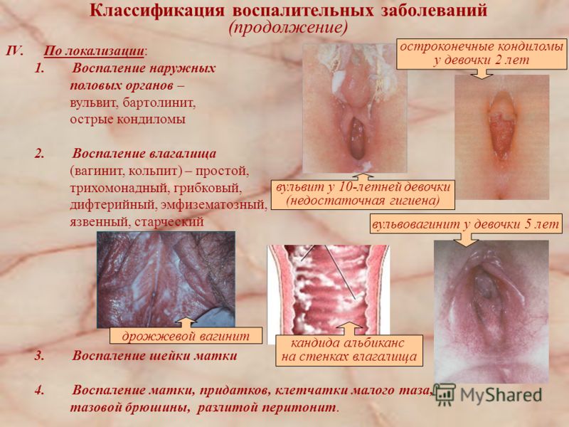 НЕО-ПЕНОТРАН ФОРТЕ свечи - инструкция по применению НЕО-ПЕНОТРАН ФОРТЕ свечи - инструкция по применению