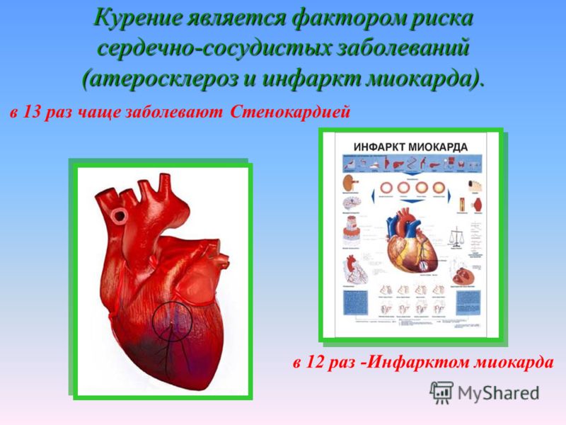 Курение является фактором риска сердечно-сосудистых заболеваний (атеросклероз и инфаркт миокарда). в 13 раз чаще заболевают Стенокардией в 12 раз -Инфарктом миокарда