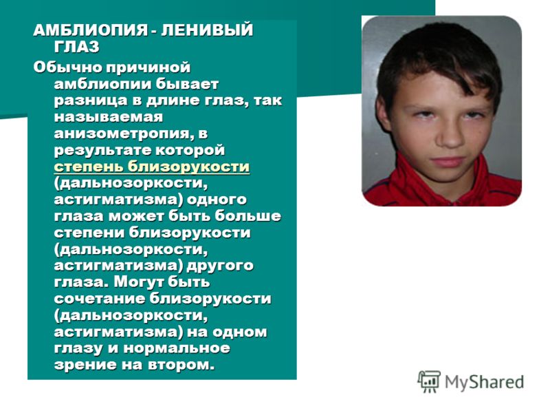 Избавиться от близорукости реально