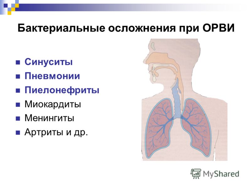 Настойка грецкого ореха на водке: состав, рецепты и Массаж простаты дома мужу для кайфа пальцем и