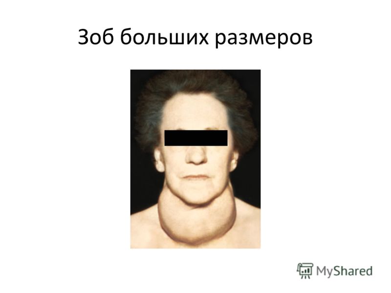Боль внизу живота и месячных нет 3 месяц
