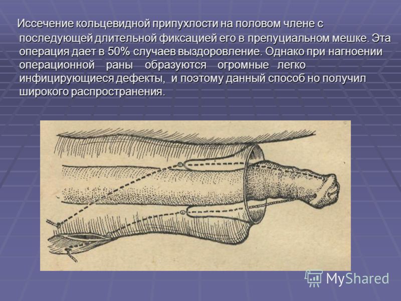 Последний день курорта нужно проводить на члене