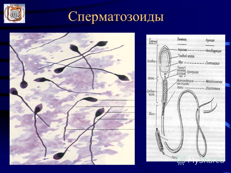 Рисунки сперматозоидов Рисунки сперматозоидов