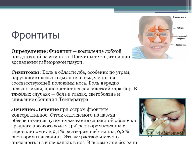 Признаки гайморита и его лечение в домашних условиях Признаки гайморита и его лечение в домашних условиях