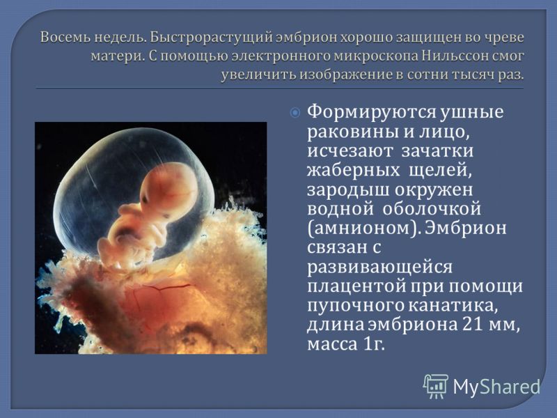 Формируются ушные раковины и лицо, исчезают зачатки жаберных щелей, зародыш окружен водной оболочкой ( амнионом ). Эмбрион связан с развивающейся плацентой при помощи пупочного канатика, длина эмбриона 21 мм, масса 1 г.