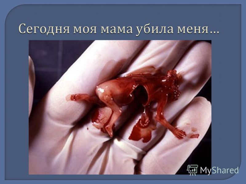 Какие продукты можно и нужно приносить в роддом женщине после родов Как происходит зачатие ребенка фантастическое видео Курсы молодой мамы