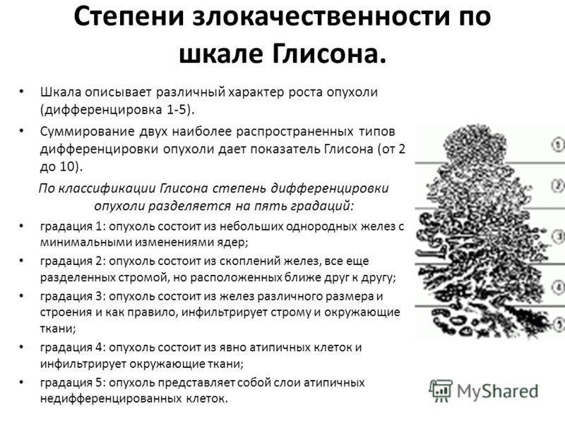 Свободный простат специфический антиген Свободный простат специфический антиген