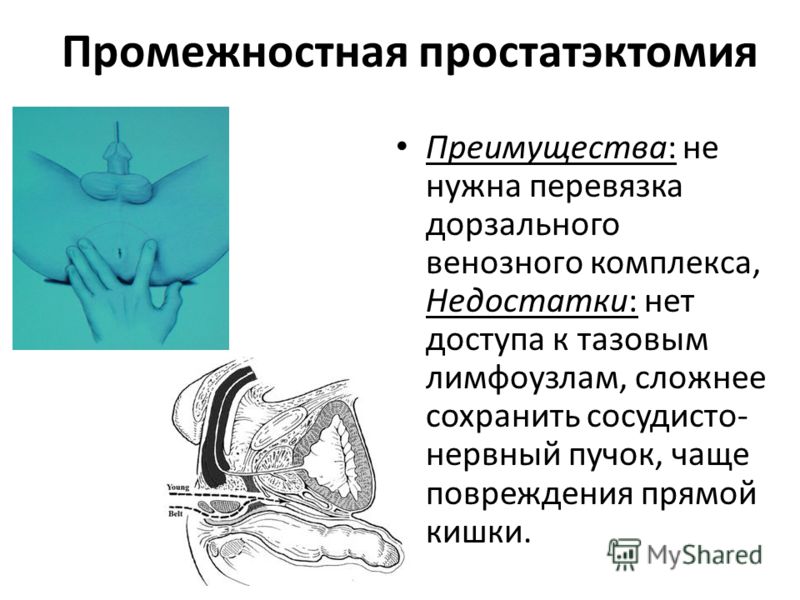 Женский цистит: выбираем лекарство Артроз: как остановить разрушение суставов? - Статьи