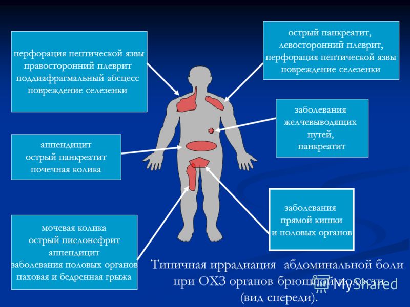 Острый живот в гинекологии первая помощь