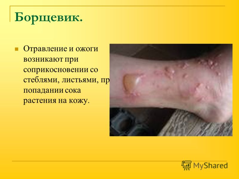 Картопляники рецепт с пошагово Картопляники рецепт с пошагово